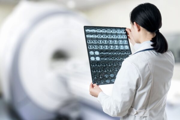 Un profesional sanitario con bata blanca examina una serie de imágenes de resonancia magnética frente a un equipo de resonancia magnética para evaluar el posible riesgo cerebral. La persona se coloca de espaldas a la cámara y sostiene las imágenes a contraluz.
